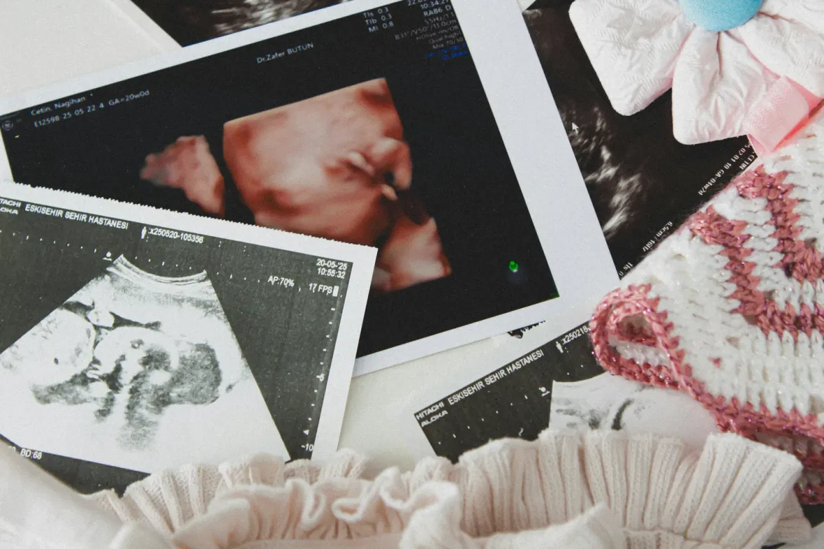 Échographies posées sur un lange, à côté de vêtements de naissance tricotés