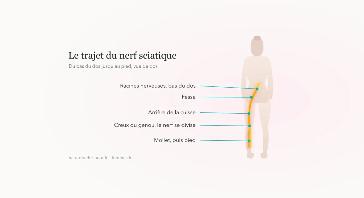 Schéma du trajet du nerf sciatique sur une silhouette de femme vue de dos : bas du dos, fesse, arrière de la cuisse, creux du genou, mollet et pied