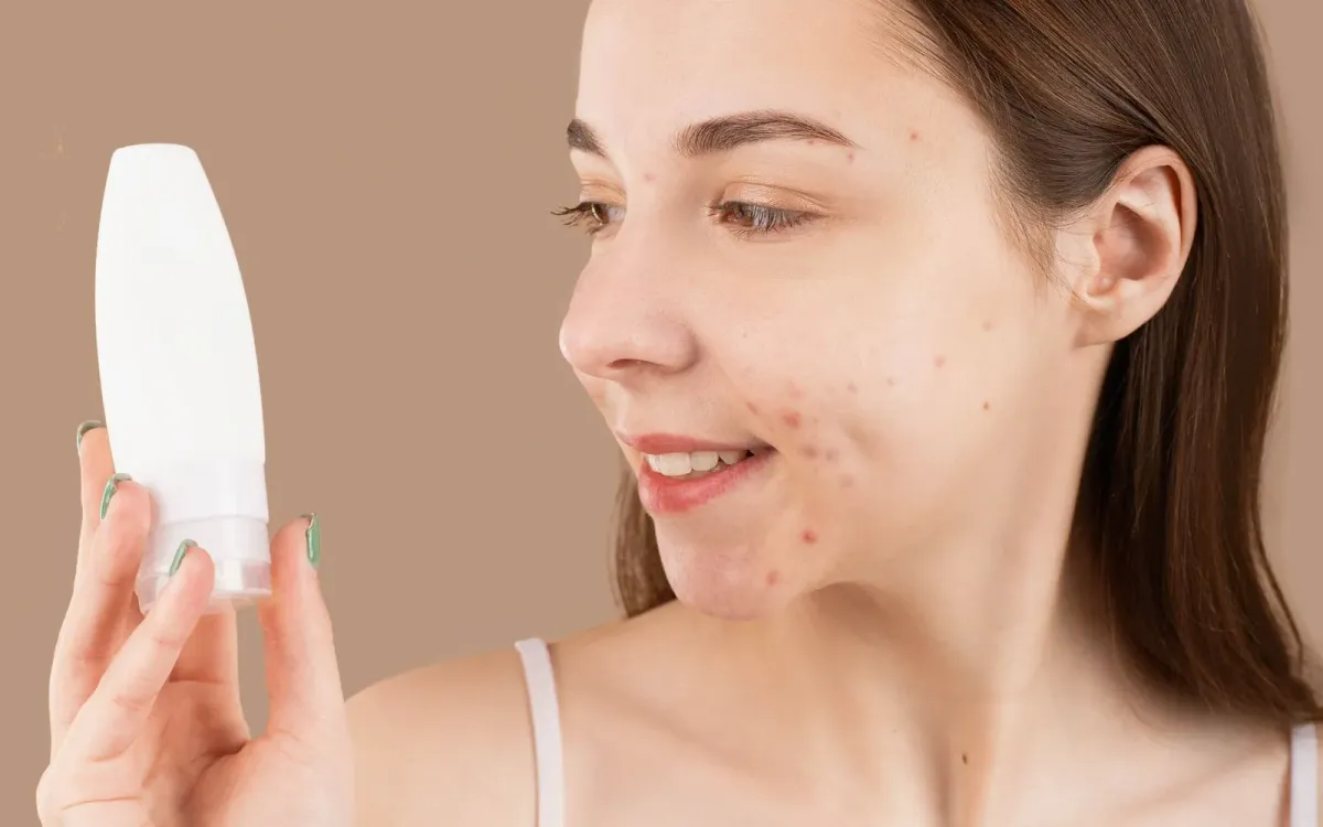 Jeune femme à la peau marquée par l'acné, un soin à la main